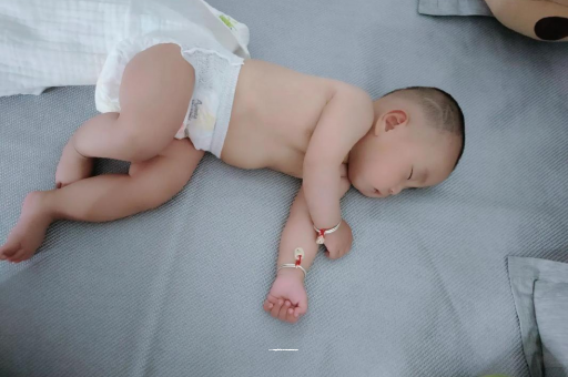 鹰潭六个月宝宝眼睛散光